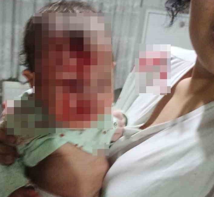 Ankara’da, 4 aylık erkek bebeğini cam sehpanın üzerine atarak yaralayan
