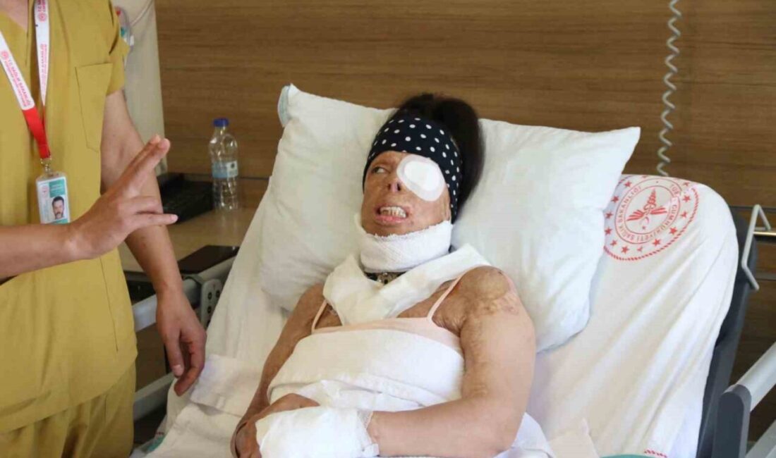 Eski sevgilisi tarafından, uyuduğu esnada yüzüne, vücudunun çeşitli yerlerine kezzap