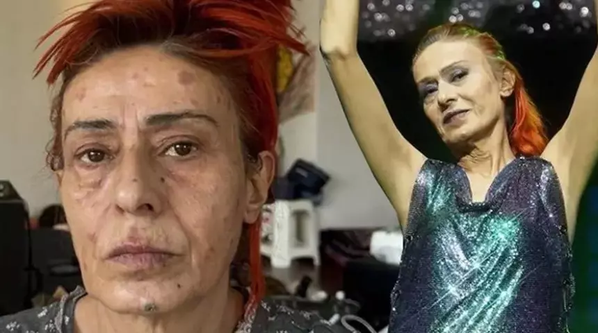 Türk müziğinin efsane sesi Yıldız Tilbe, bugün (21 Şubat 2026)