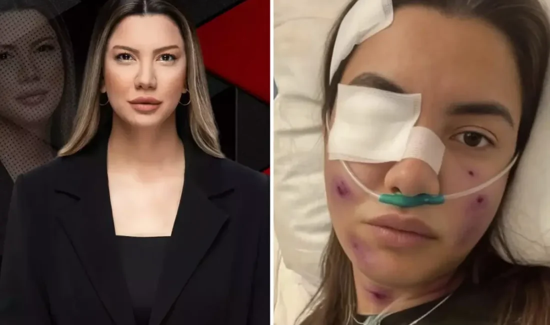 Gazeteci Fulya Öztürk'ün ağır bir trafik kazası geçirdiğine dair sosyal