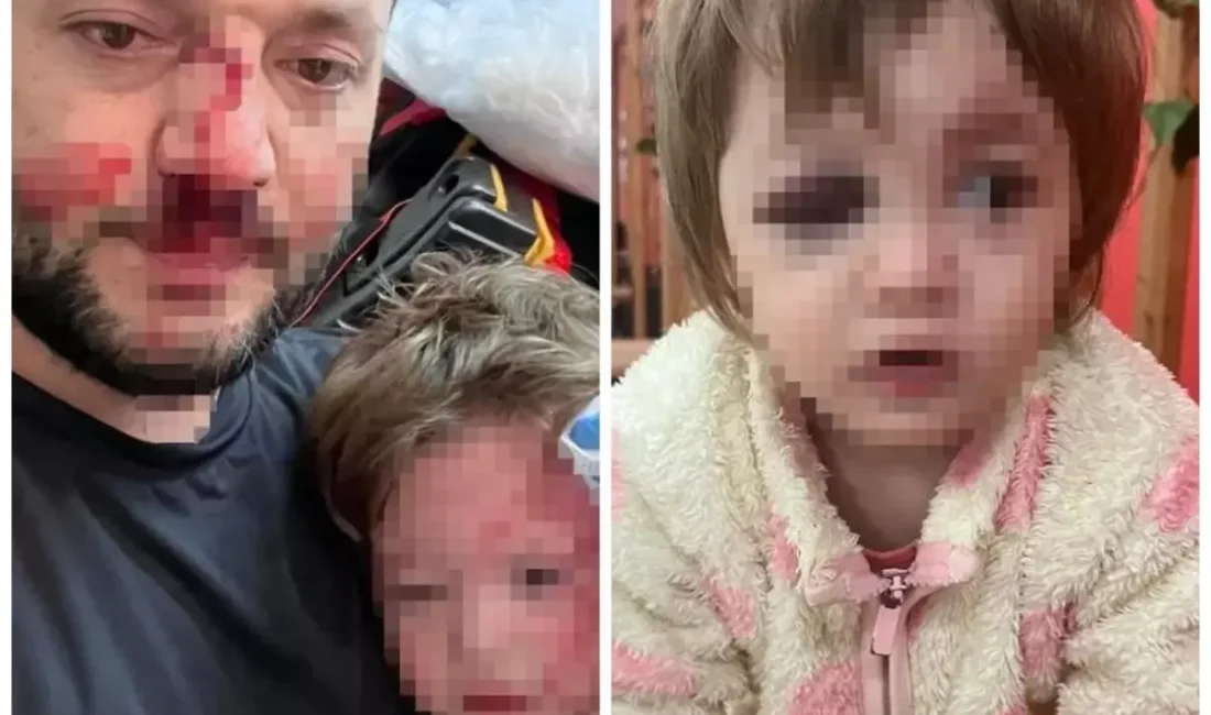 Yalova'nın Çınarcık ilçesine bağlı Esenköy beldesinde, "çocuk gürültüsü" bahanesiyle başlayan