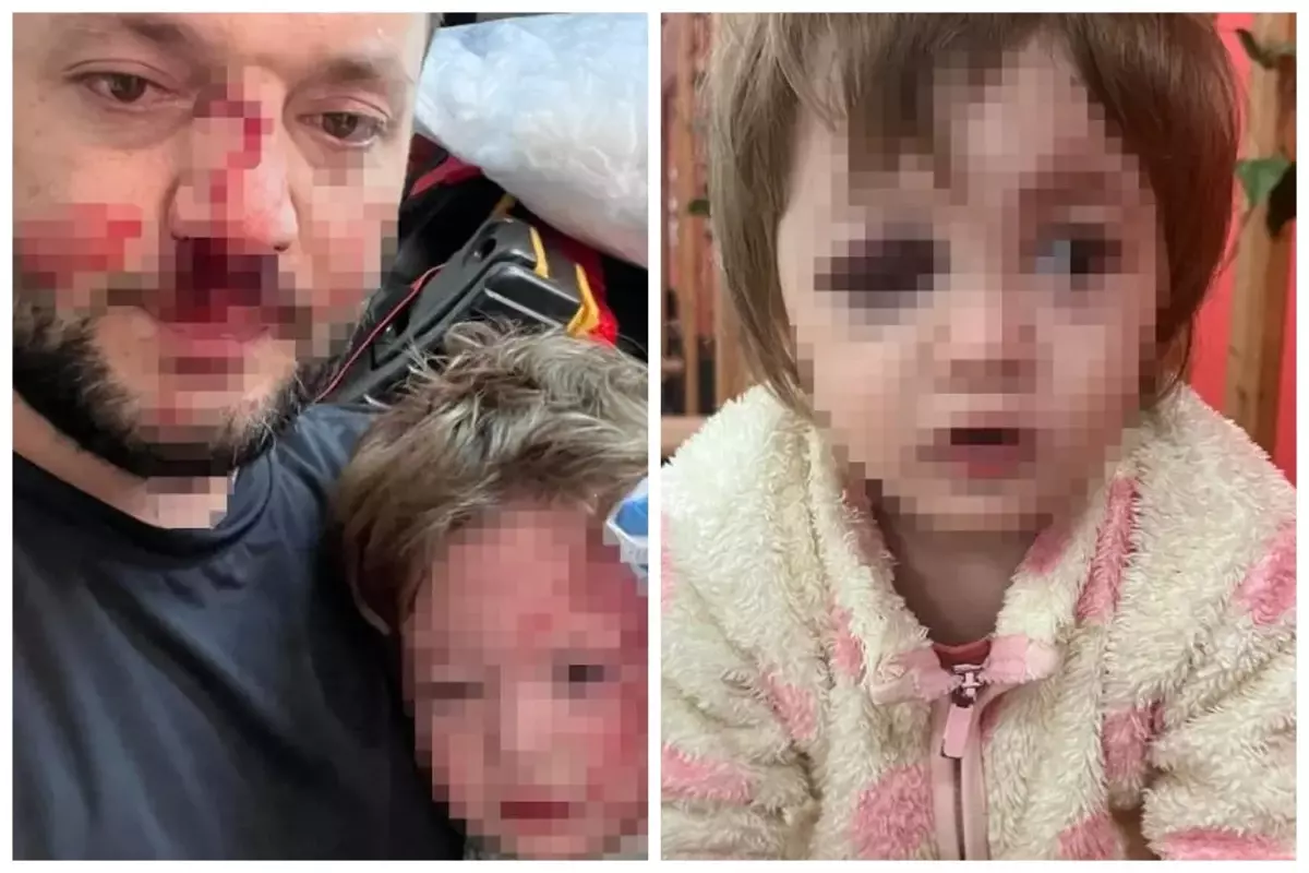 Yalova'nın Çınarcık ilçesine bağlı Esenköy beldesinde, "çocuk gürültüsü" bahanesiyle başlayan