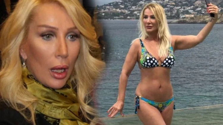 Geçirdiği estetik operasyonları saklamayan ve bu konudaki açık sözlülüğüyle bilinen