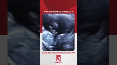 Kanal 3Sal, Haziran 30, 2026 2:00pmURL:Embed:Anne karnından gelen alışkanlık… 📶https://kanal3.com.tr/