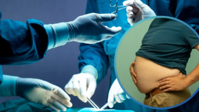 Obezite, yalnızca kişinin kilosunun belirli bir değerin üzerinde olması şeklinde