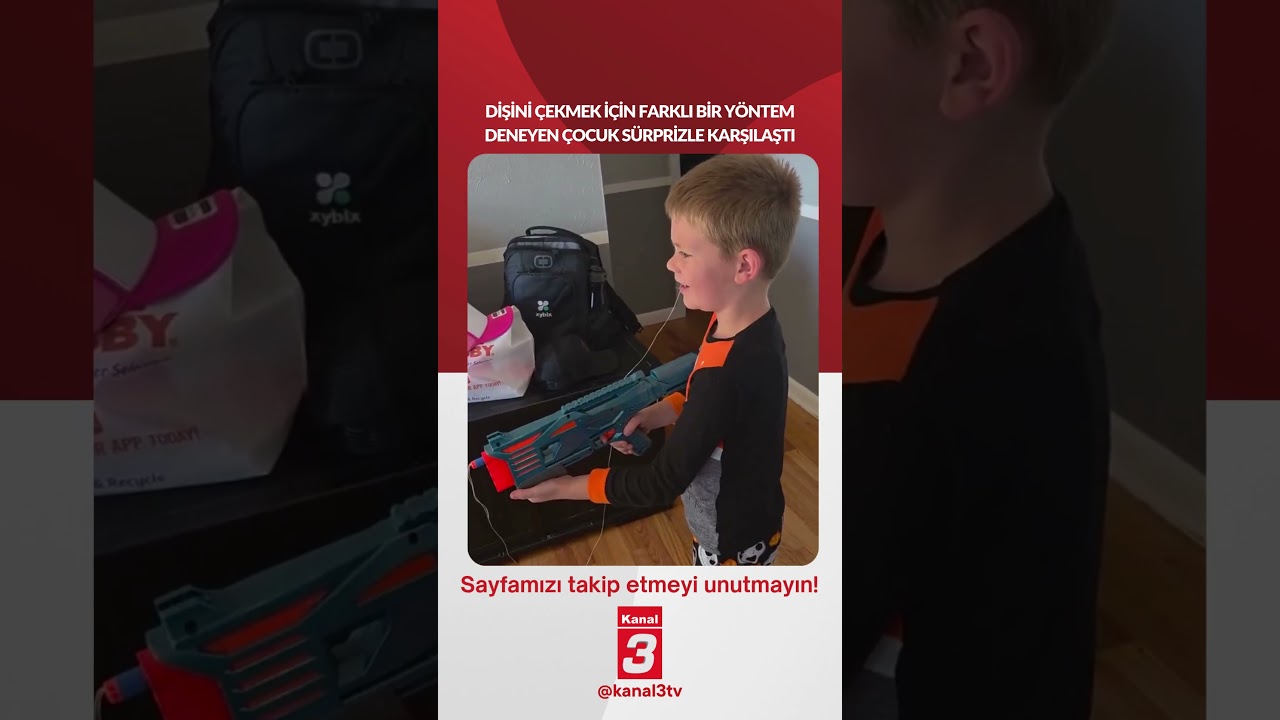Dişini çekmek için farklı bir yöntem deneyen çocuk sürprizle karşılaştı!